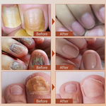 Suero Reparador y fortalecedor de Uñas - Nails Repairing + ENVIO GRATIS