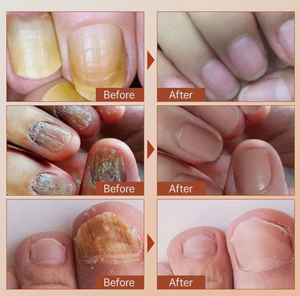 Suero Reparador y fortalecedor de Uñas - Nails Repairing + ENVIO GRATIS