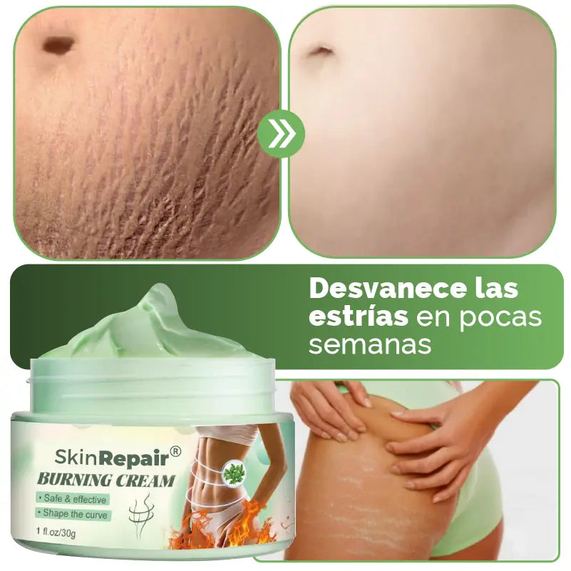 CREMA ANTI ESTRÍAS Y CELULITIS SKIN REPAIR + ENVIO GRATIS