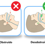 PROTECTOR BUCAL ANTIRONQUIDOS + ENVIO GRATIS